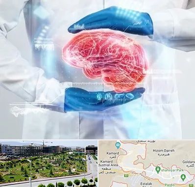 دکتر مغز و اعصاب در پردیس