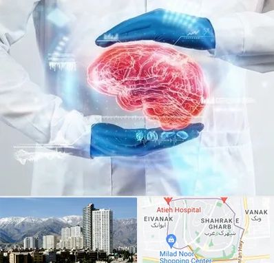 دکتر مغز و اعصاب در شهرک غرب 