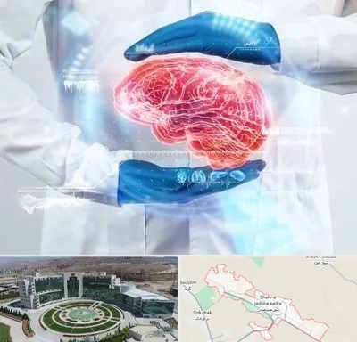 دکتر مغز و اعصاب در صدرا
