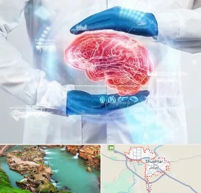 دکتر مغز و اعصاب در شوشتر