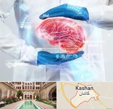 دکتر مغز و اعصاب در کاشان