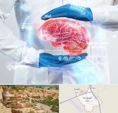 دکتر مغز و اعصاب در امیدیه