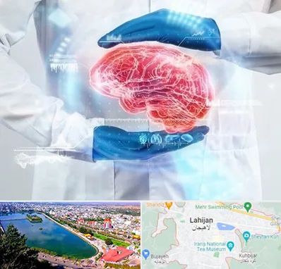 دکتر مغز و اعصاب در لاهیجان