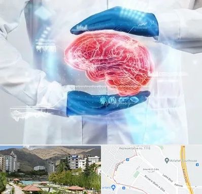 دکتر مغز و اعصاب در شهر زیبا 