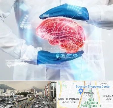 دکتر مغز و اعصاب در پونک 