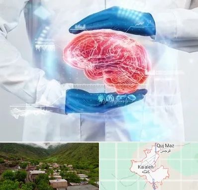 دکتر مغز و اعصاب در کلاله