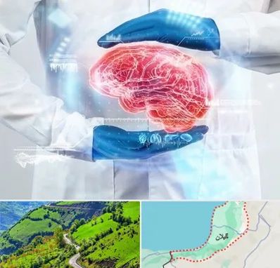 دکتر مغز و اعصاب در گیلان