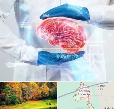 دکتر مغز و اعصاب در کردکوی