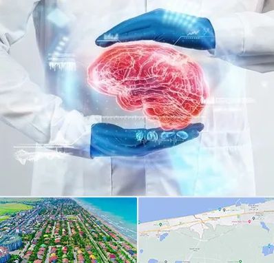 دکتر مغز و اعصاب در فریدونکنار