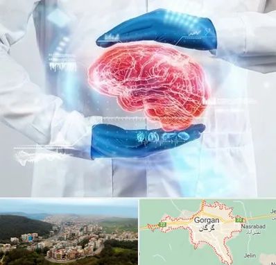 دکتر مغز و اعصاب در گرگان