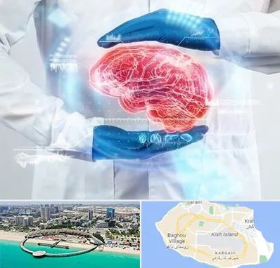دکتر مغز و اعصاب در کیش