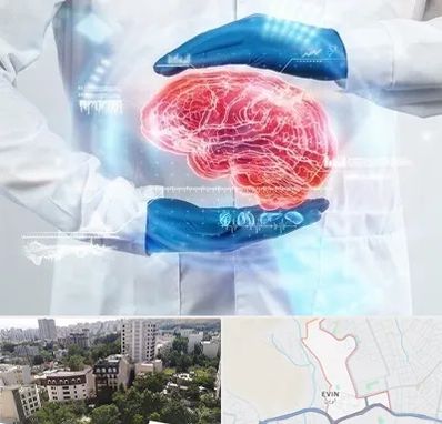 دکتر مغز و اعصاب در اوین