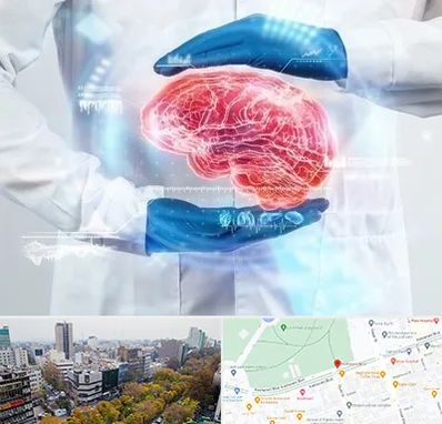 دکتر مغز و اعصاب در بلوار کشاورز 