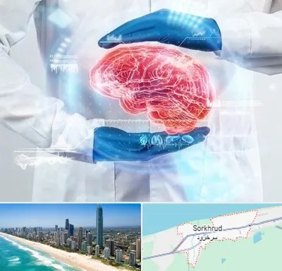 دکتر مغز و اعصاب در سرخرود