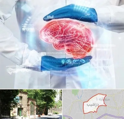 دکتر مغز و اعصاب در دزاشیب