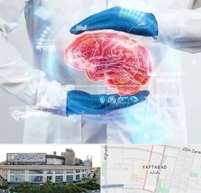 دکتر مغز و اعصاب در یافت آباد