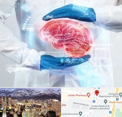 دکتر مغز و اعصاب در جردن 