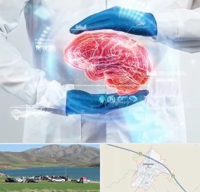 دکتر مغز و اعصاب در دهگلان