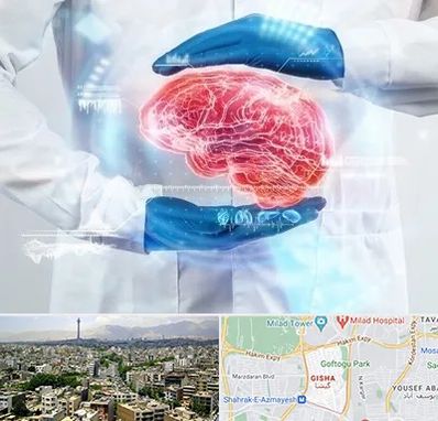 دکتر مغز و اعصاب در گیشا 