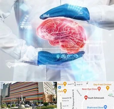 دکتر مغز و اعصاب در سهروردی 