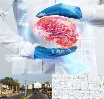 دکتر مغز و اعصاب در ضیابری رشت 