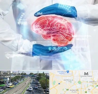 دکتر مغز و اعصاب در جنوب تهران 