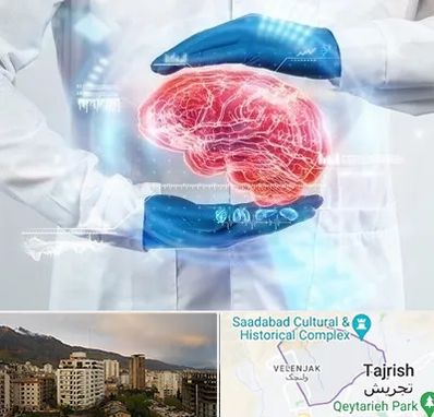 دکتر مغز و اعصاب در زعفرانیه 