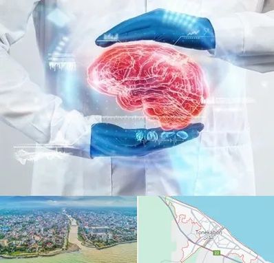 دکتر مغز و اعصاب در تنکابن