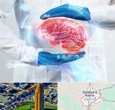 دکتر مغز و اعصاب در گنبد کاووس