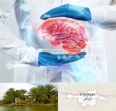 دکتر مغز و اعصاب در شادگان
