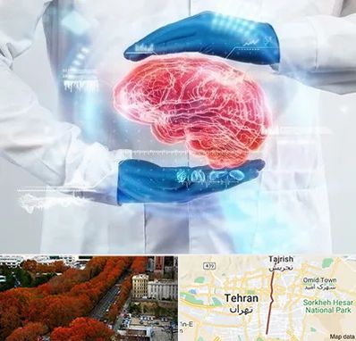 دکتر مغز و اعصاب در ولیعصر 