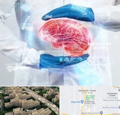 دکتر مغز و اعصاب در اکباتان 