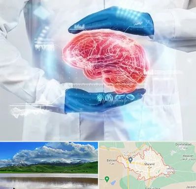 دکتر مغز و اعصاب در مرند