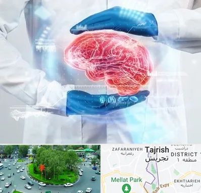 دکتر مغز و اعصاب در تجریش 