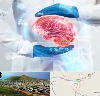 دکتر مغز و اعصاب در بیجار