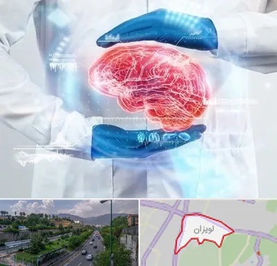 دکتر مغز و اعصاب در لویزان