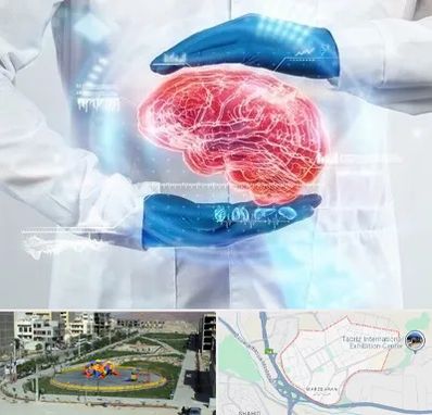دکتر مغز و اعصاب در مرزداران تبریز
