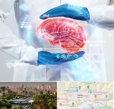 دکتر مغز و اعصاب در منطقه 1 تهران 