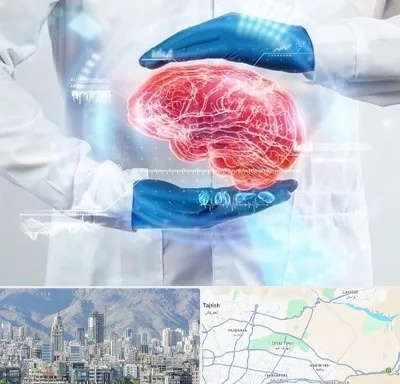 دکتر مغز و اعصاب در شمال شرق تهران