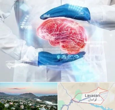 دکتر مغز و اعصاب در لواسان