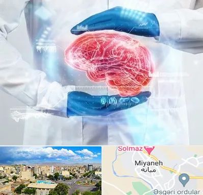 دکتر مغز و اعصاب در میانه