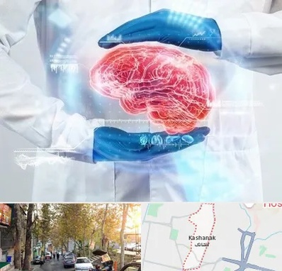 دکتر مغز و اعصاب در کاشانک