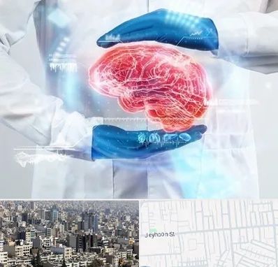 دکتر مغز و اعصاب در جیحون