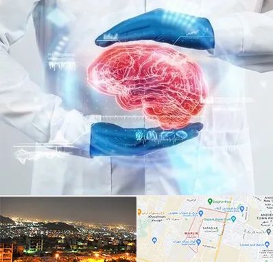 دکتر مغز و اعصاب در مارلیک کرج 