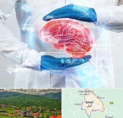 دکتر مغز و اعصاب در آمل