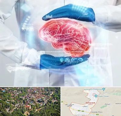 دکتر مغز و اعصاب در دماوند