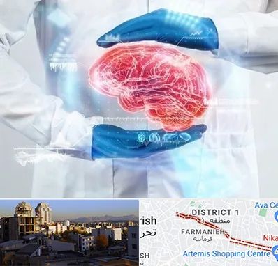 دکتر مغز و اعصاب در فرمانیه 