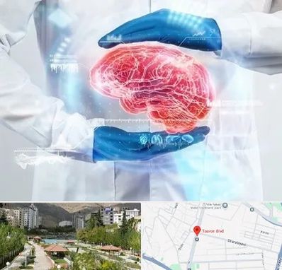 دکتر مغز و اعصاب در بلوار تعاون