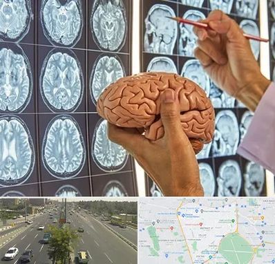 جراح مغز و اعصاب در منطقه 17 تهران 