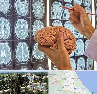 جراح مغز و اعصاب در رودسر